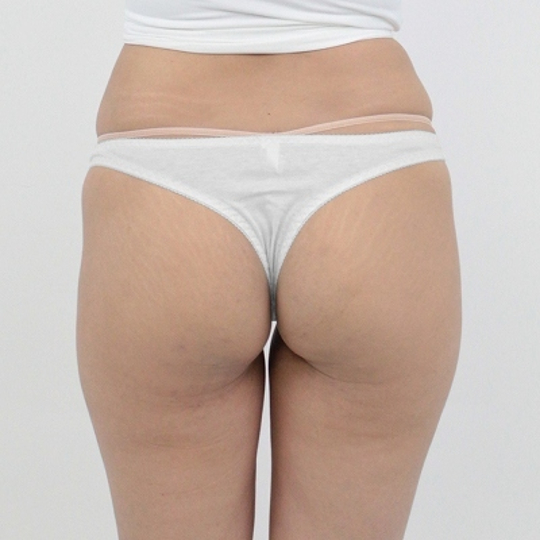 Skin-Friendly Cotton T-Back Panties L White - Breathable thong for women - Kanojo Toys