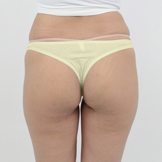 Skin-Friendly Cotton T-Back Panties M Yellow - Comfy ladies' underpants - Kanojo Toys