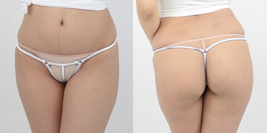Two-way Stretchy G-String