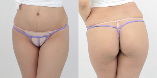 Two-way Stretchy G-String